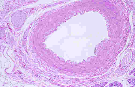 Research continues to investigate the relatinship between stress, depression and coronary heart disease